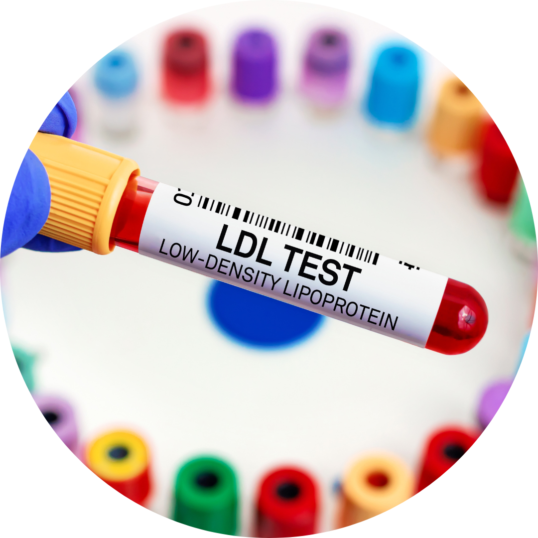 LDL Interaction and Immune Defense